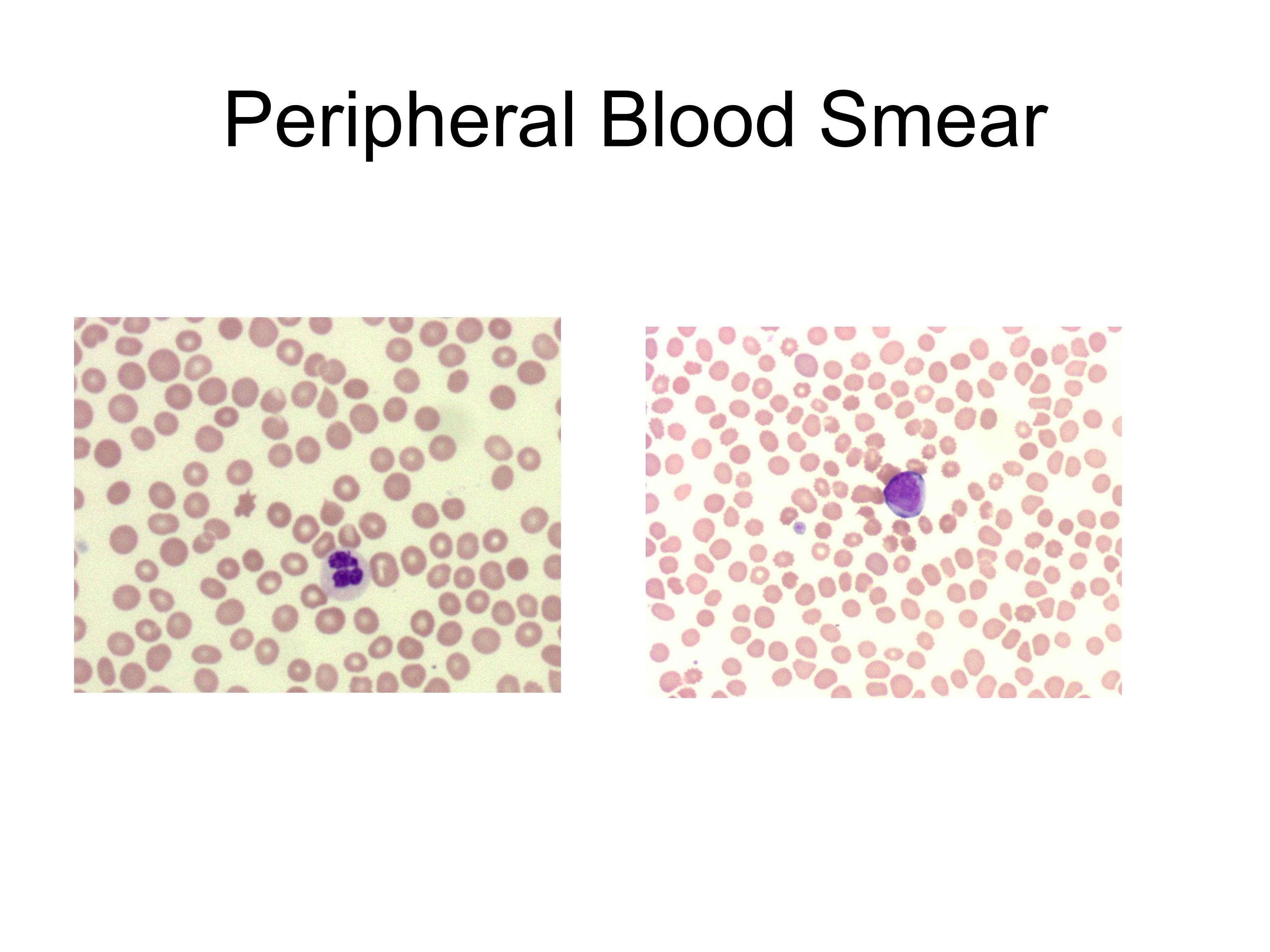 Additional figure 5: Peripheral blood