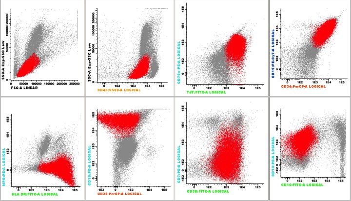 Flow cytometry immunophelotype