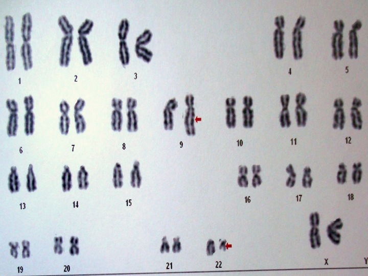 karyotype