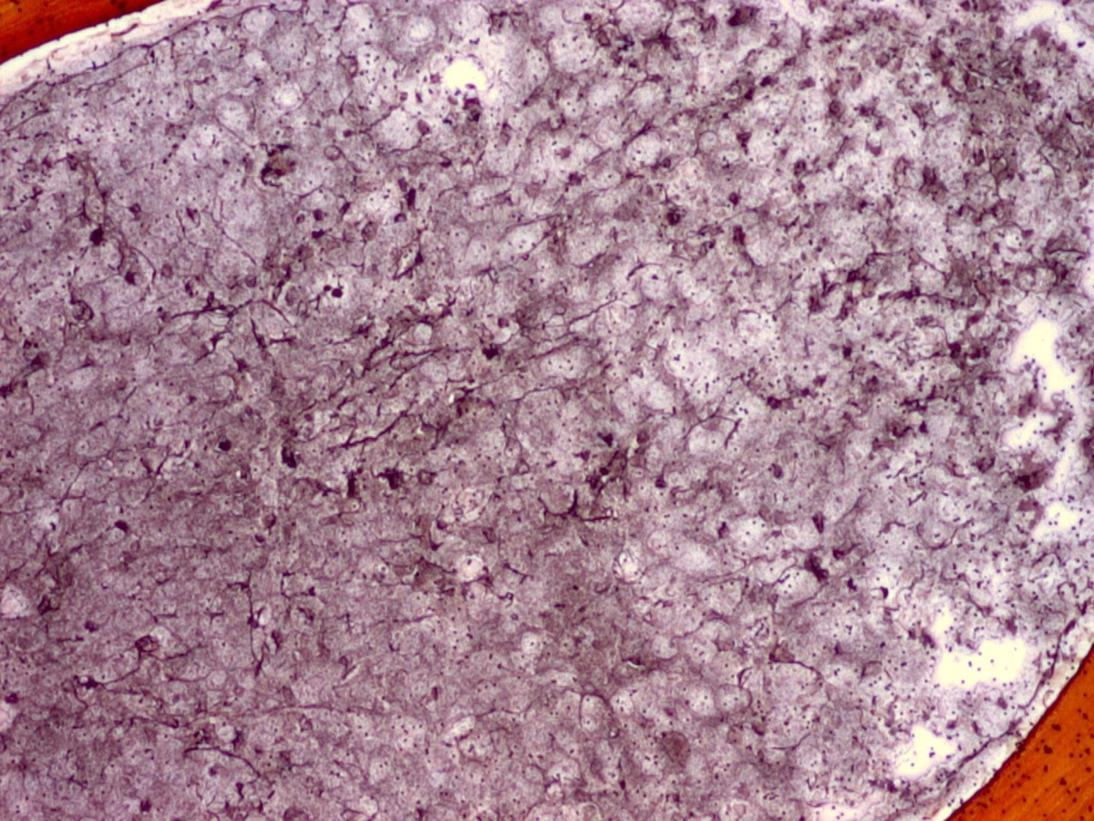 BM reticulin fiber