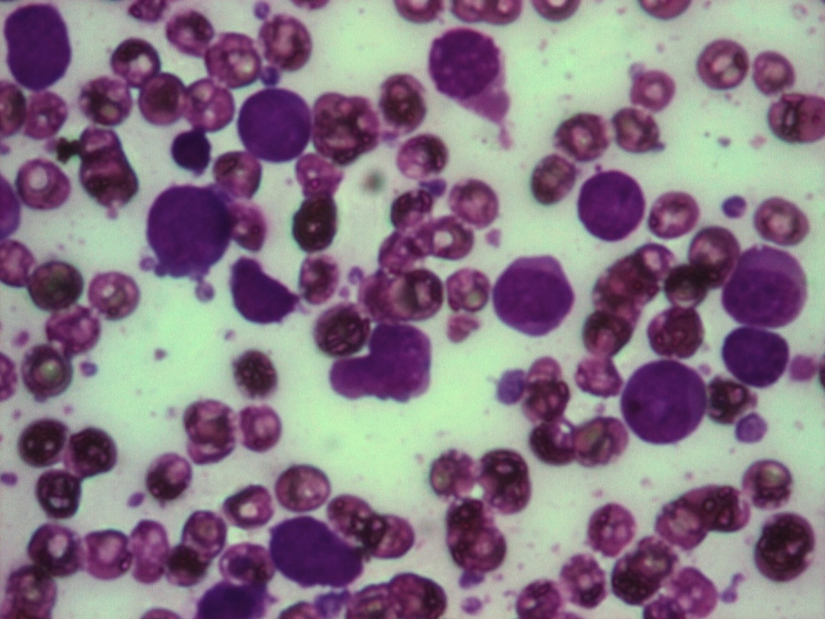 BM smear 40x