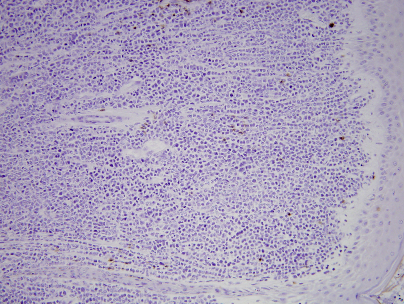 Additional figure 1: Beta F1 IHC