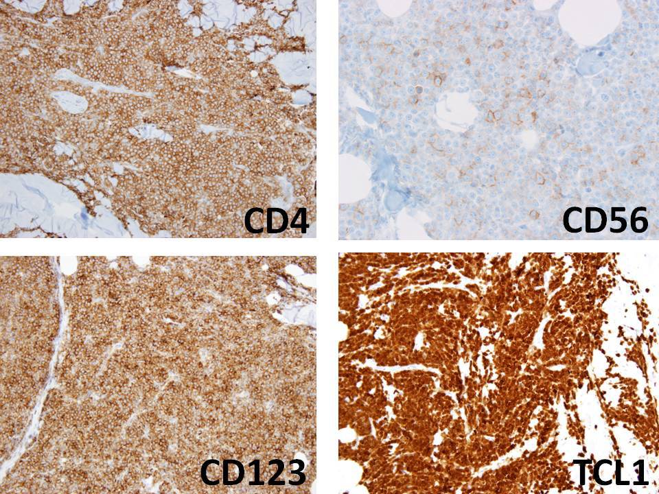 Skin biopsy, IHC