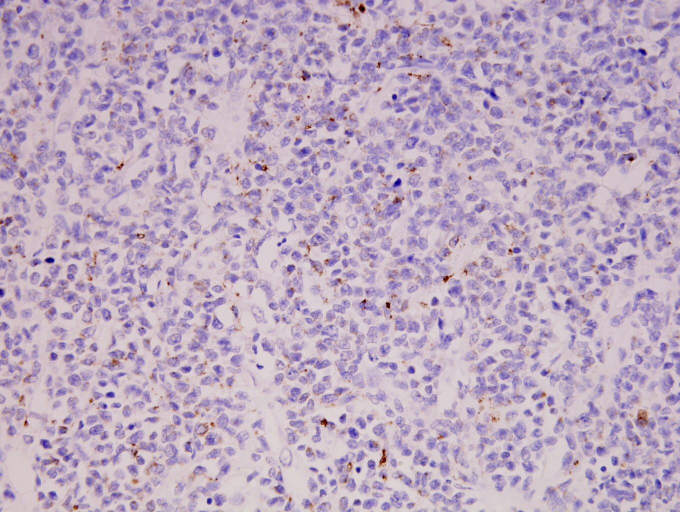 Additional figure 2: CD68 IHC, 400x