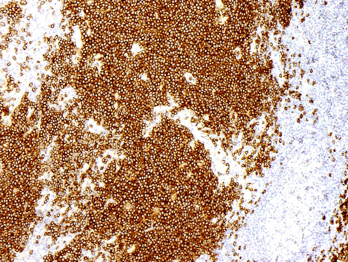 Fig 6: CD303 / BDCA2