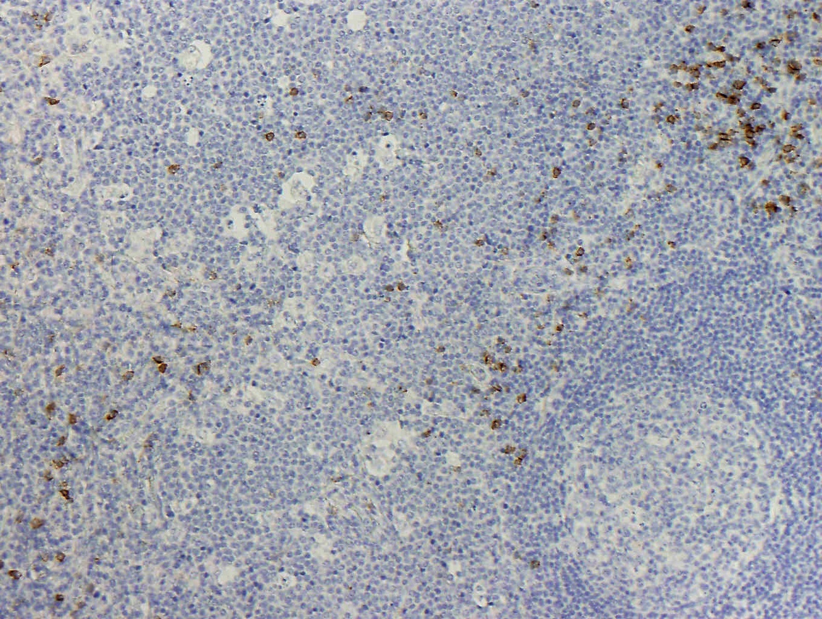 Fig 5: CD56