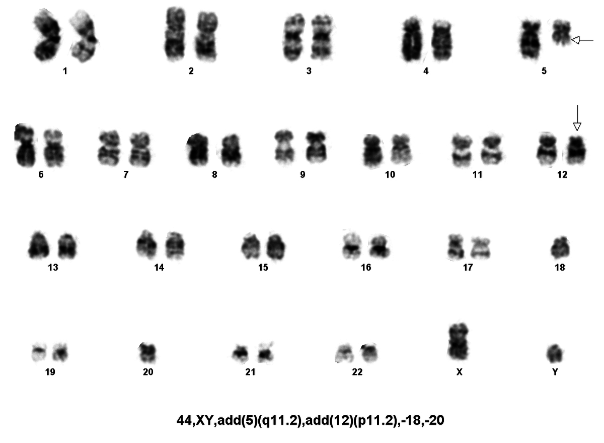 karyotype