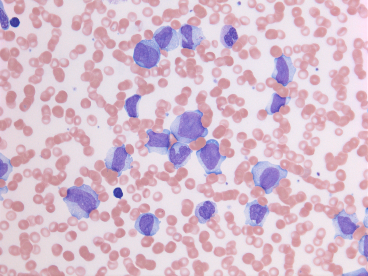 Peripheral blood