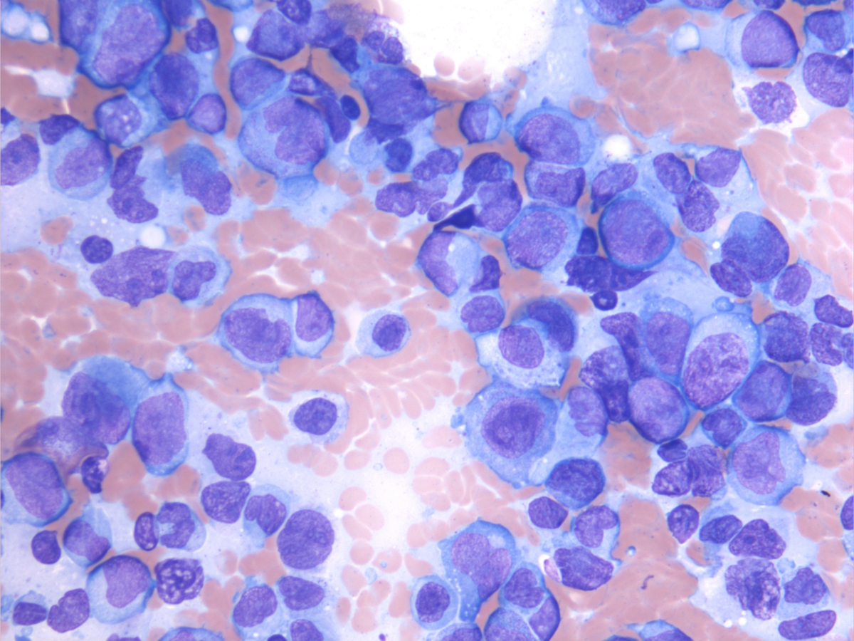 Aspirate