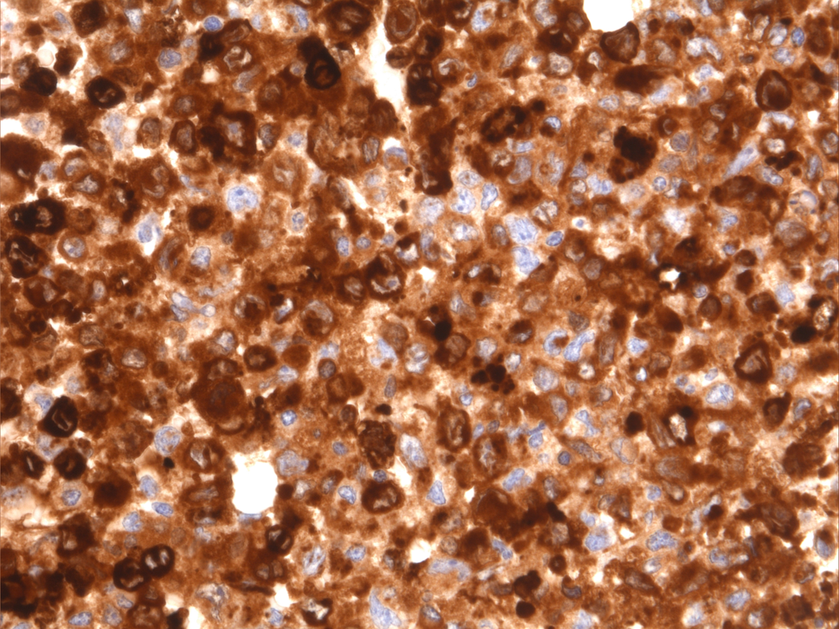 IHC: Lysozyme