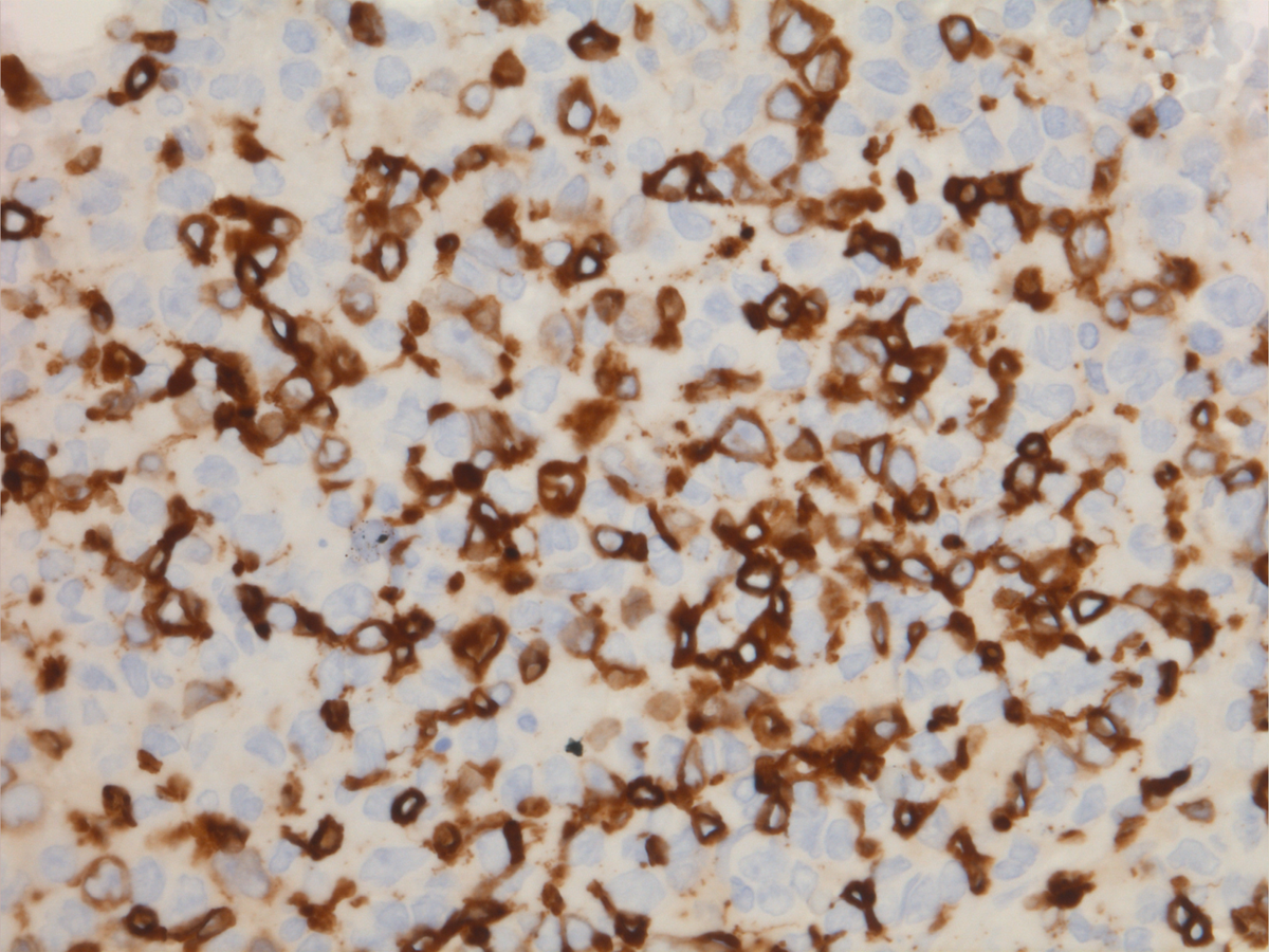 IHC: CD3