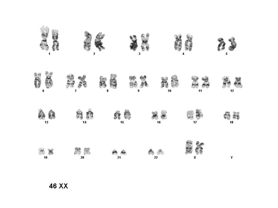 2010: karyotype