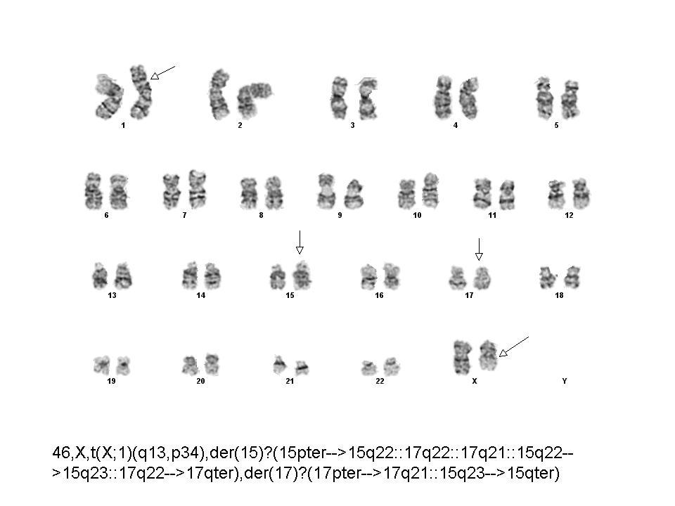 Karyotype: 2012