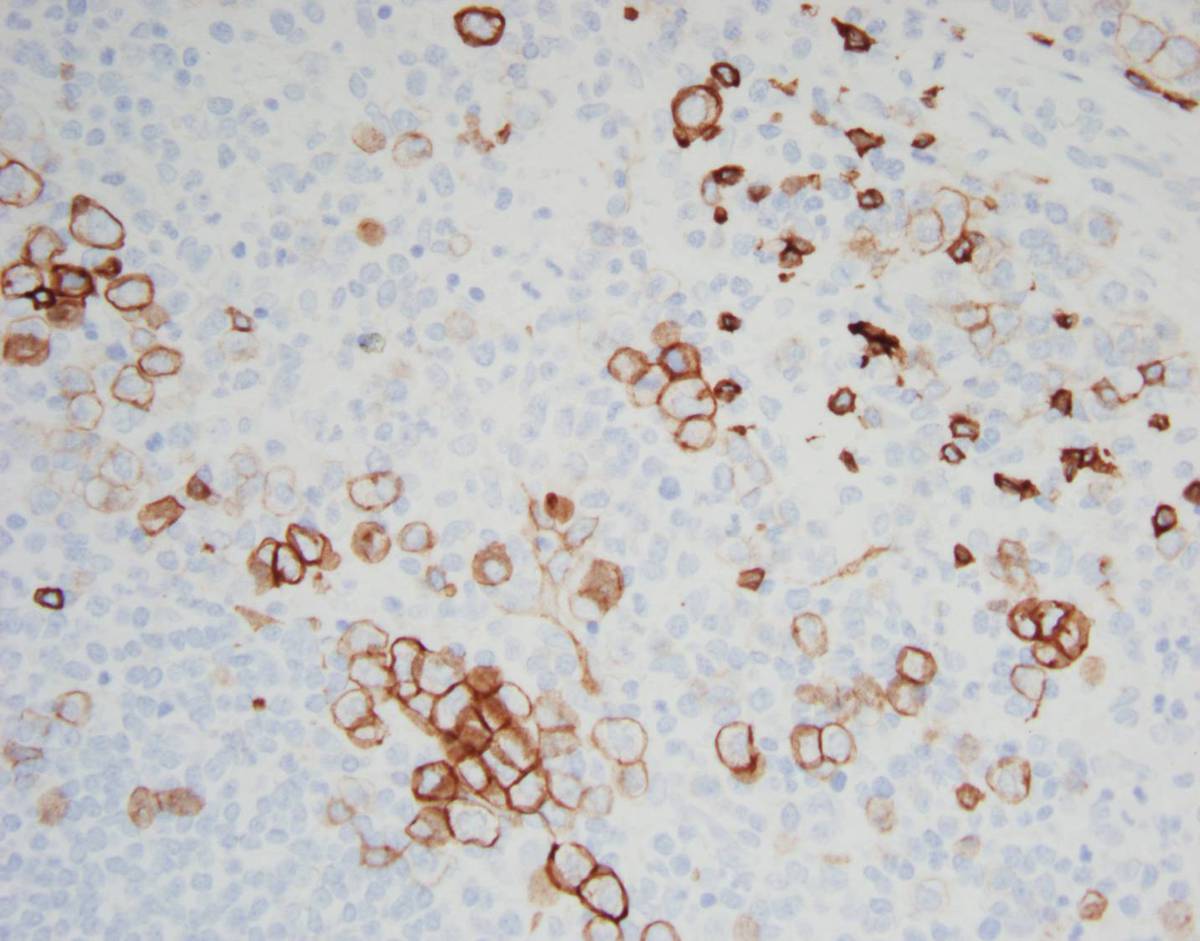 Spleen, CD117, 40X