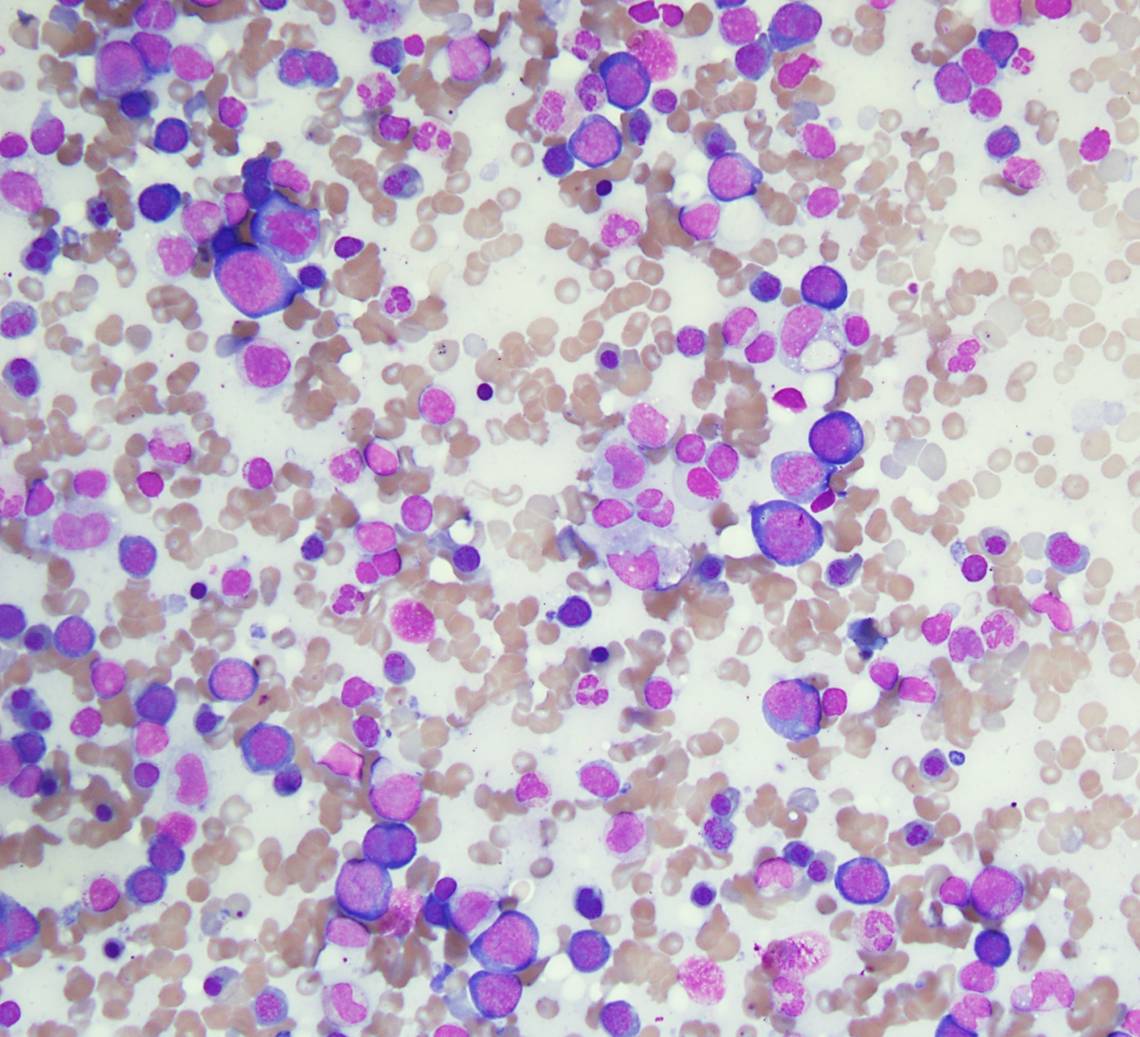 Spleen, Wright-Giemsa stained touch preparation, 40X