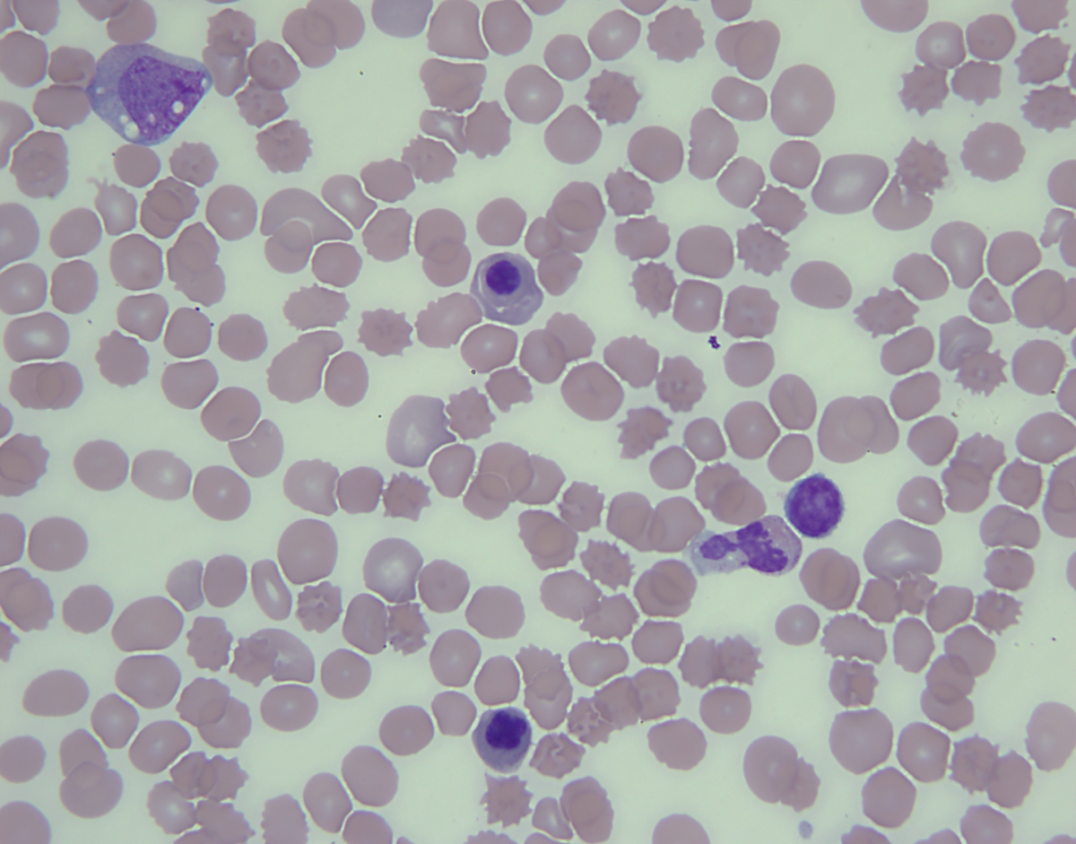 Peripheral blood, 100X