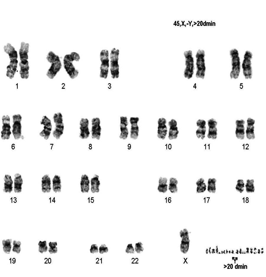 Image 6: Karyotype, many double minutes