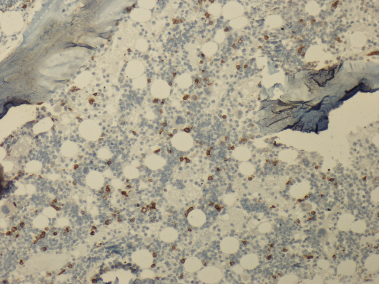 Additional figure 3: CD34 IHC (Bone marrow)