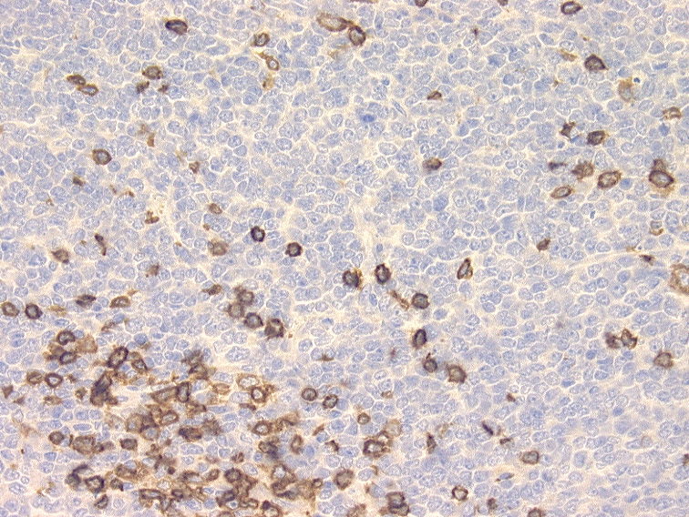 CD5
