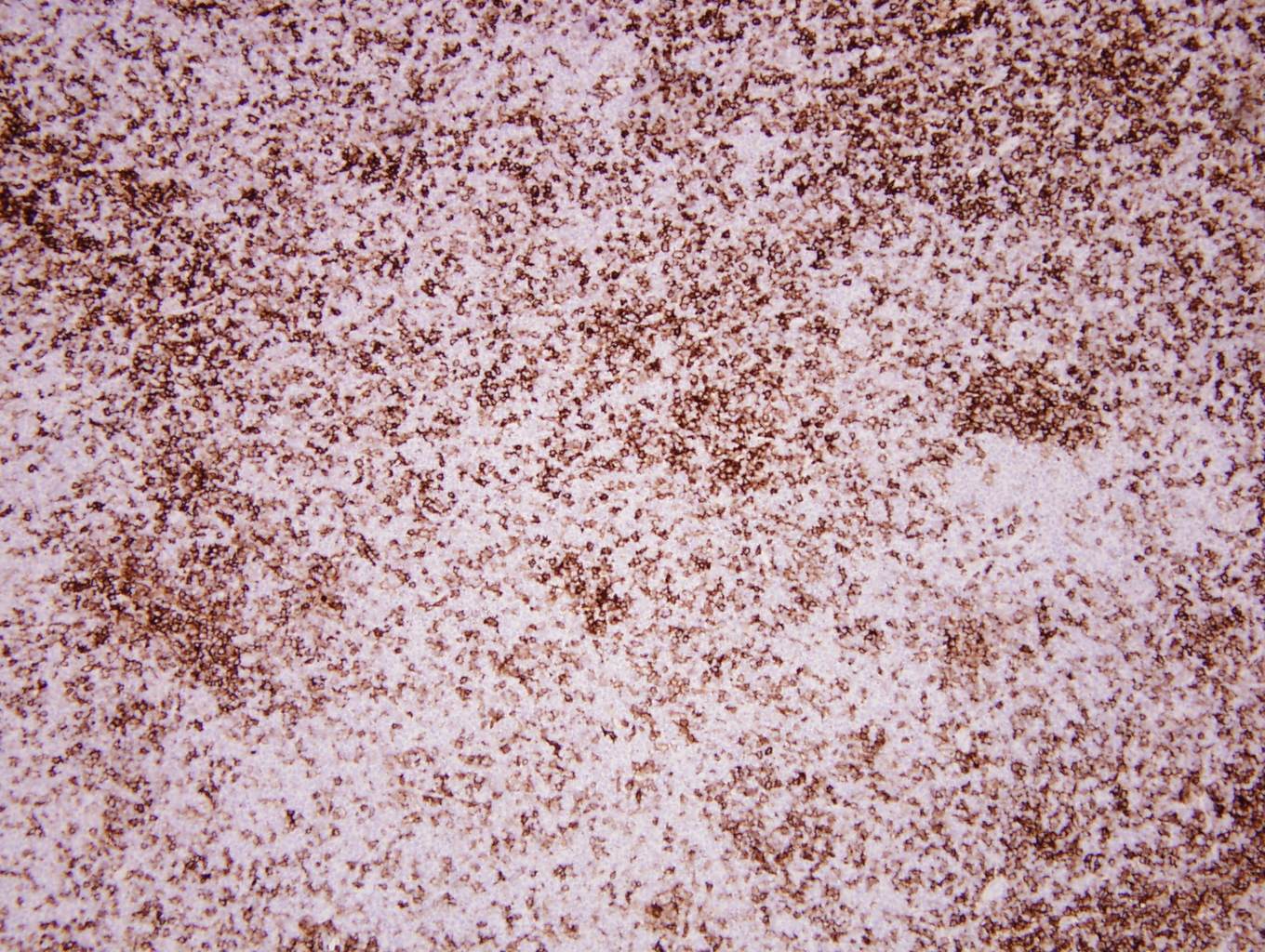 Additional figure 1: CD11c IHC, 100x