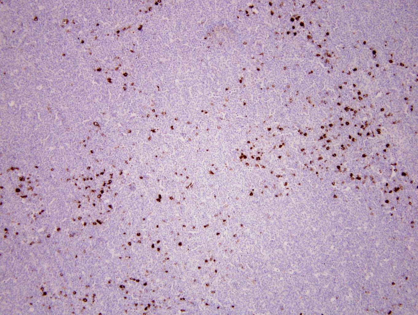 Additional figure 3: MPO IHC, 100x