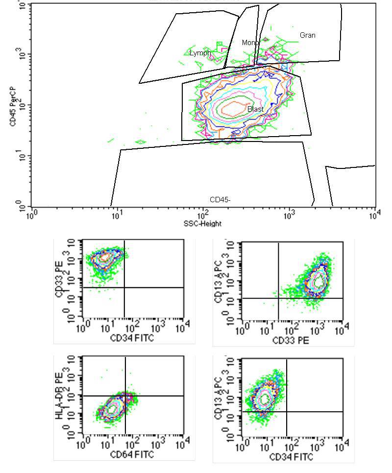 Flow cytometry, ascites fluid