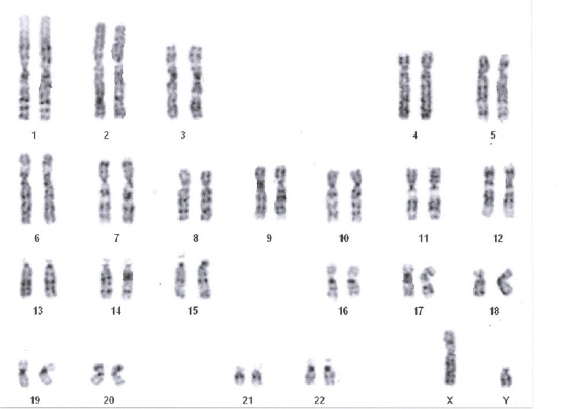 karyotype