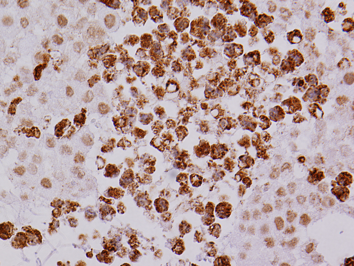 EMH with MPO+ myeloid cells