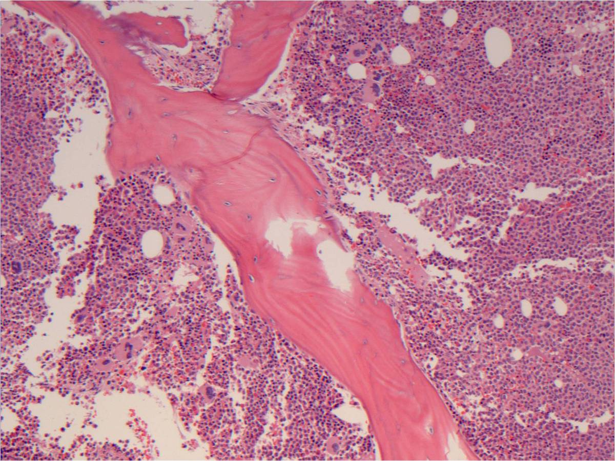 Bone Marrow 10x