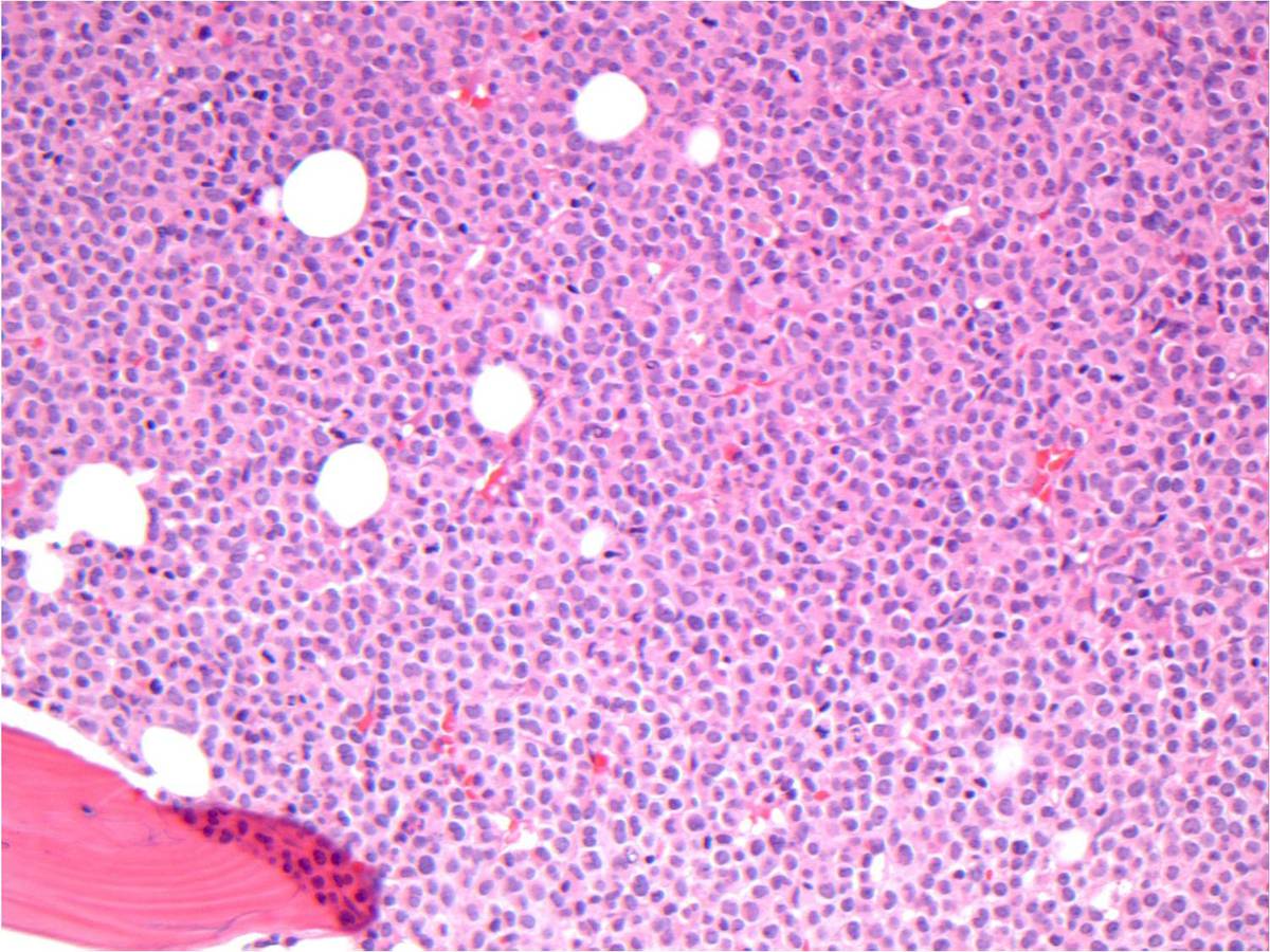 Bone Marrow 20x