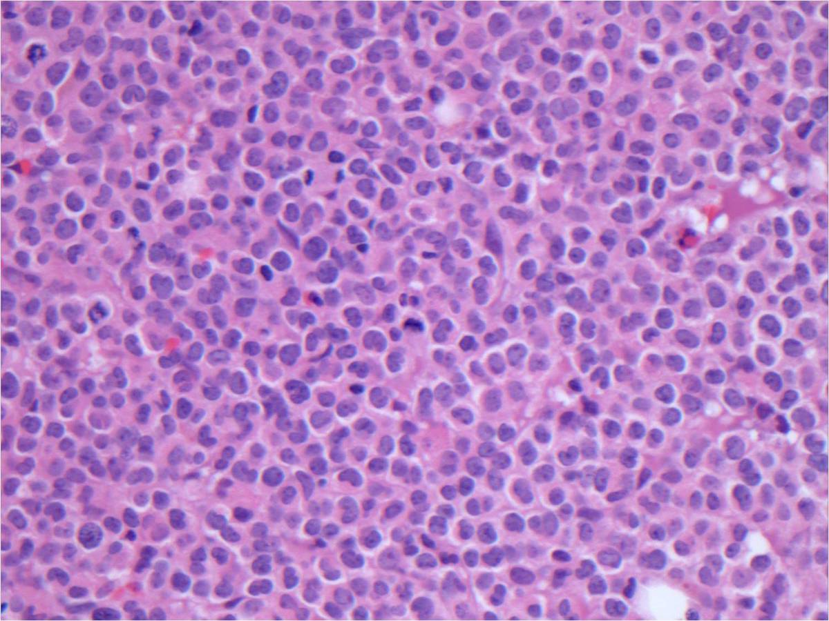Bone Marrow 40X