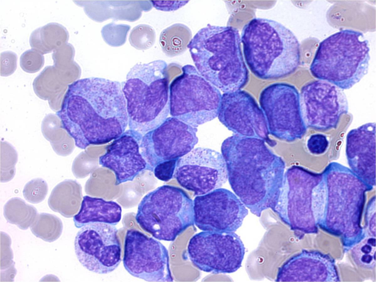 Bone Marrow Aspirate 100x #3