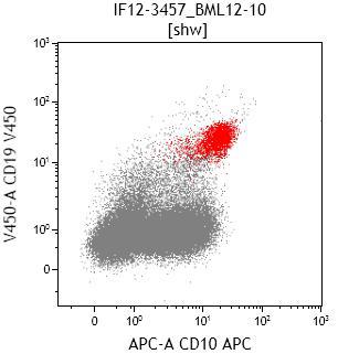 Flow cytometry CD19 and CD10 (blasts in red)