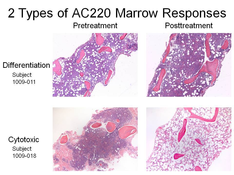 Bone marrow core biopsies, pretreatment and posttreatment for differentiation and cytotoxic responses