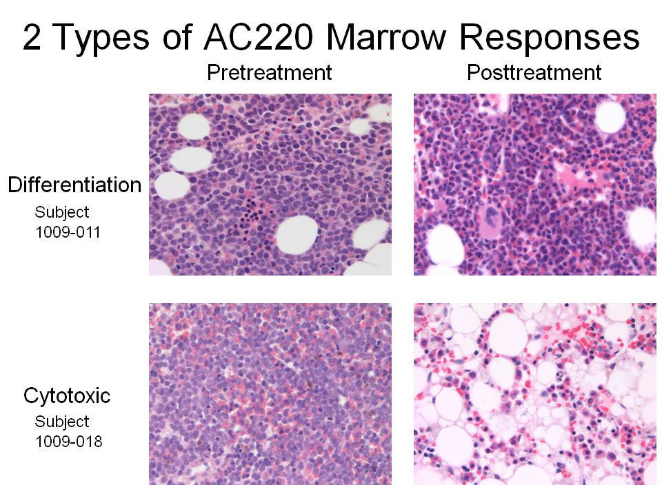 Bone marrow core biopsies, pretreatment and posttreatment for differentiation and cytotoxic responses