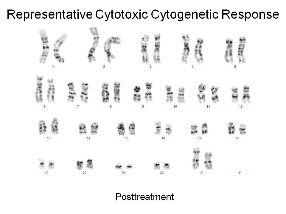 Karyotype, representative cytogenetic response, posttreatment