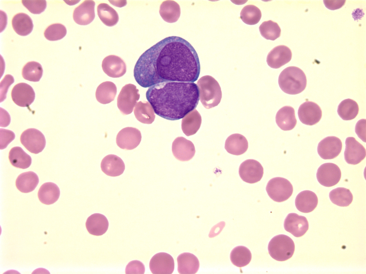 Fig.1 