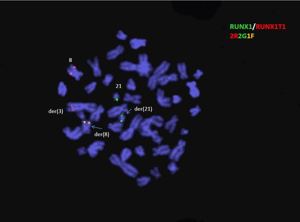 Fig 14