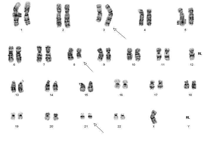 Fig 15
