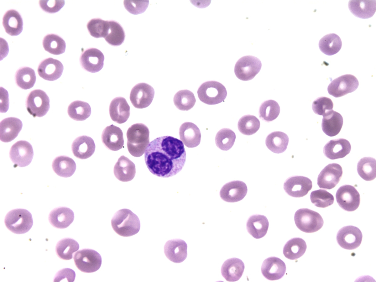 Fig 2