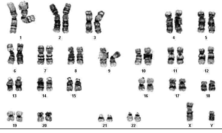 7. Karyotype