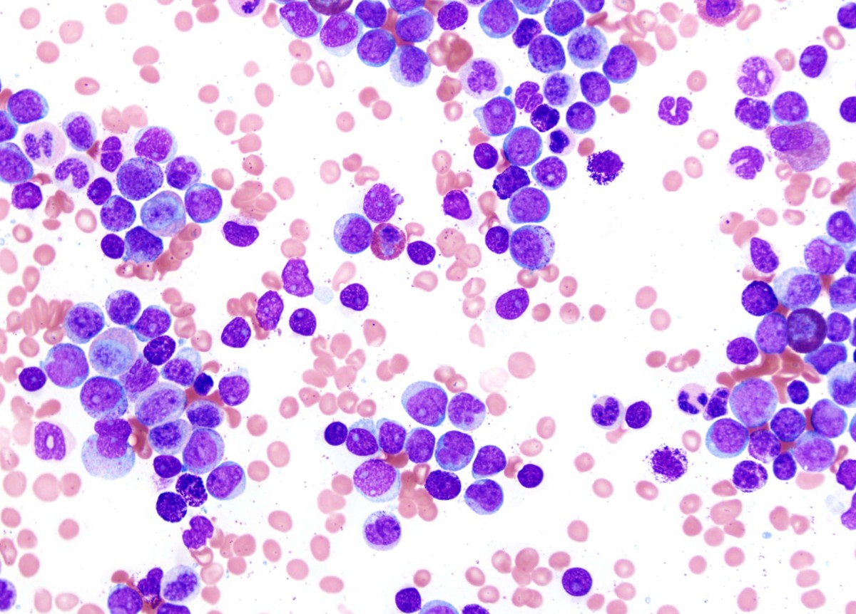 2. Aspirate smear 50x oil