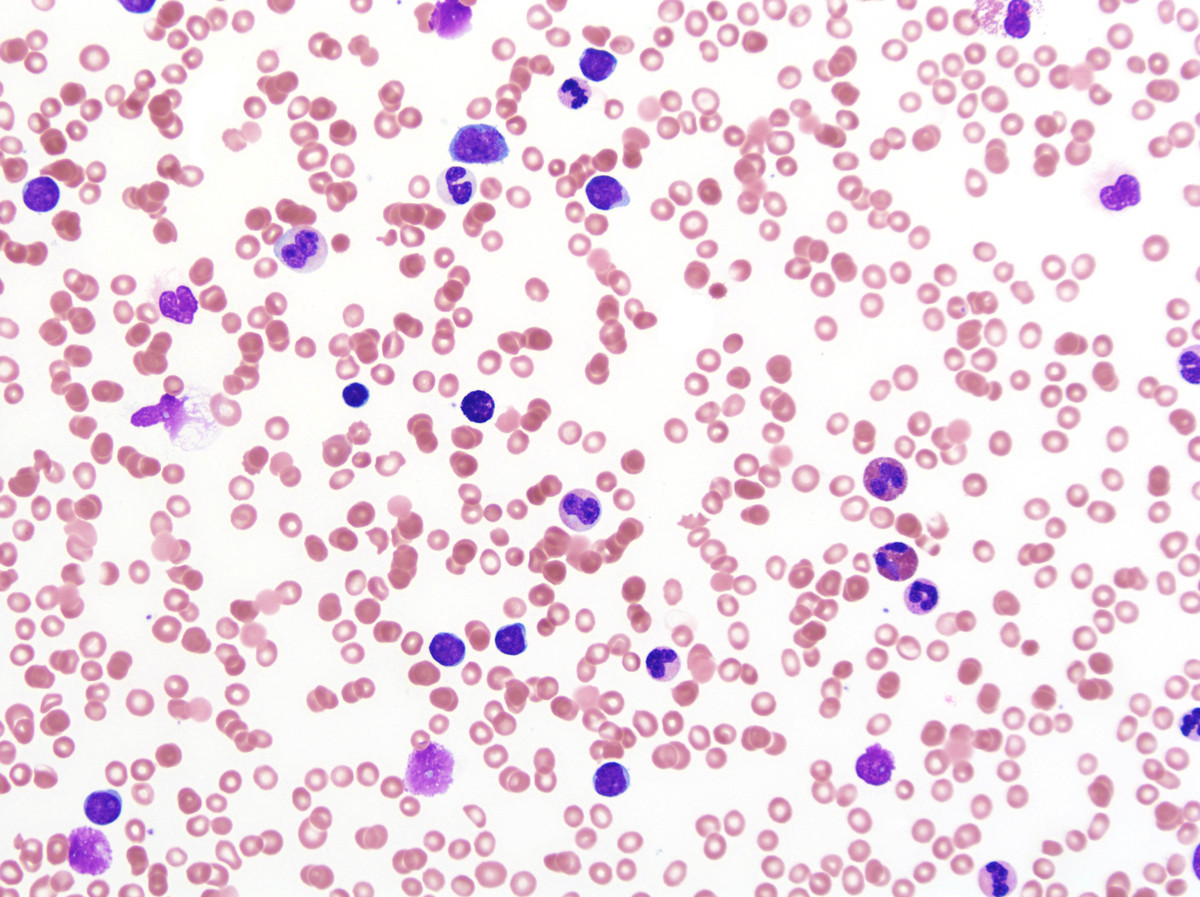 1. Peripheral blood