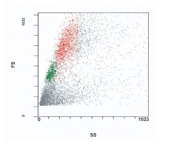 SSC vs. FSC scattergram; blasts in red, lymphocytes in green