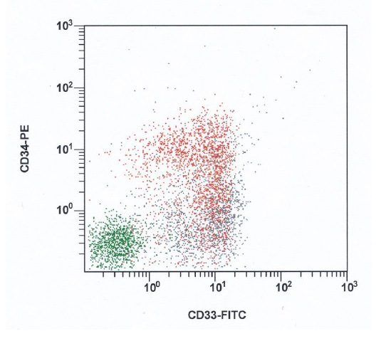 A large proportion of blasts are positive for CD34 and CD33; blasts in red, lymphocytes in green