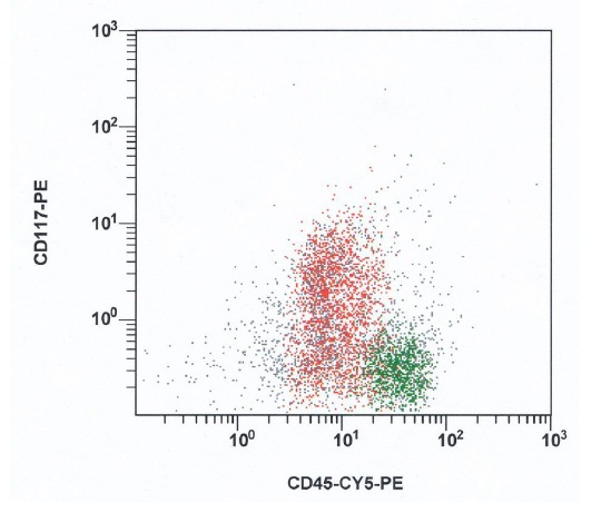 Partial expression of CD117 in blasts; blasts in red, lymphocytes in green