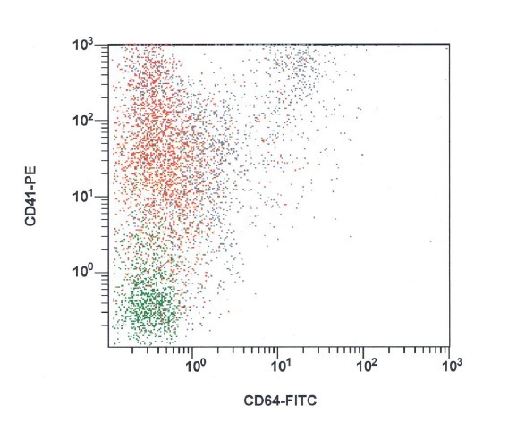 Variable expression of CD41 in blasts; blasts in red, lymphocytes in green