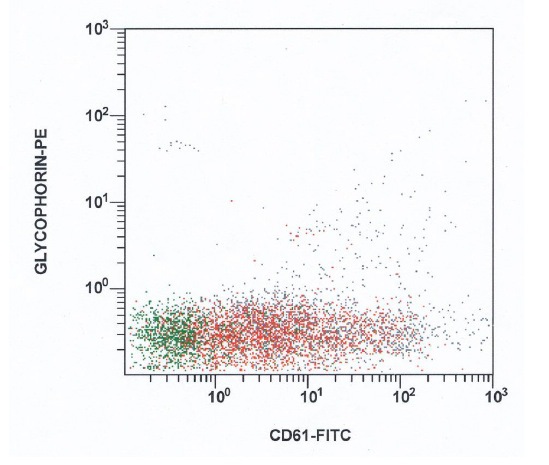 CD61 vs glycophorin; blasts in red, lymphocytes in green