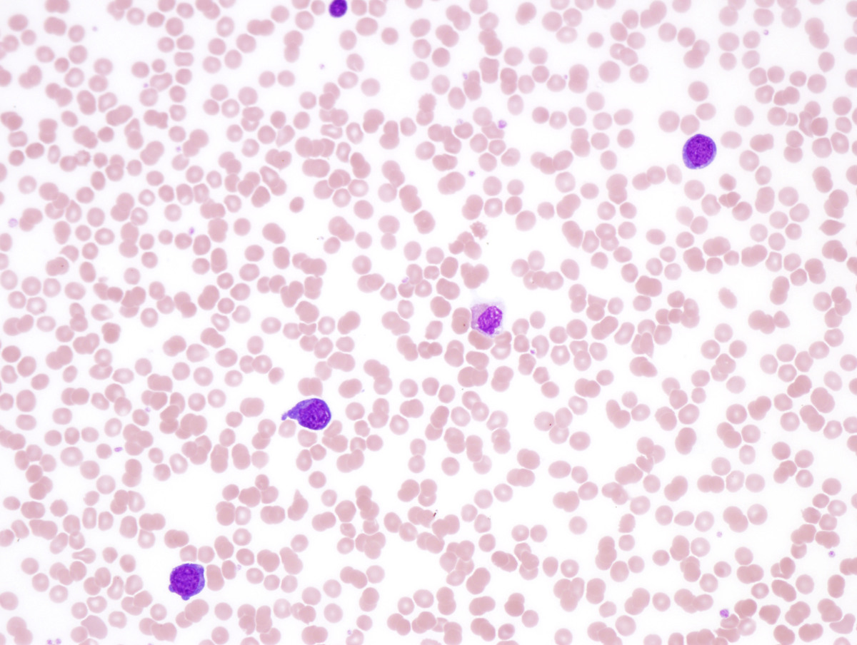 Peripheral blood (40x)
