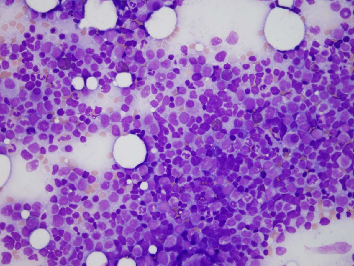 Aspirate high power view